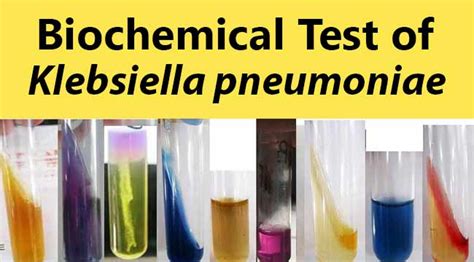 klebsiella biochemical test|klebsiella pneumoniae tsi test results.